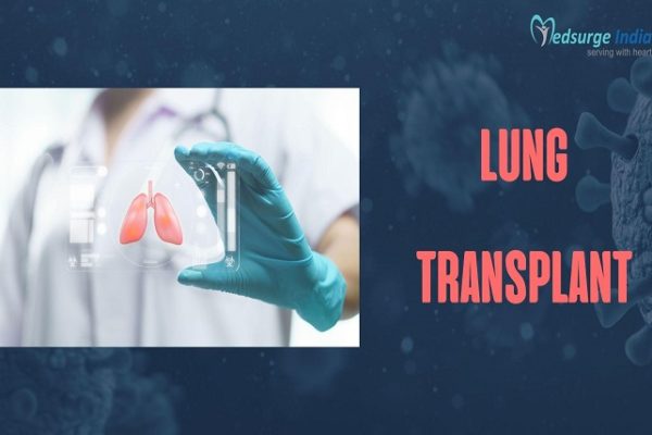 Lung Transplant: Surgery, Risks, Survival Rate & Recovery