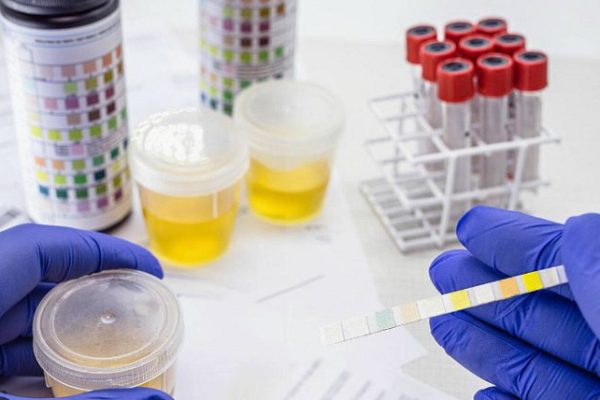2024’s Must-Have Synthetic Urine Products: A Thorough Analysis for Drug Test Success
