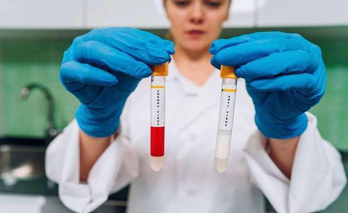 You are currently viewing Key Factors That Determine the Cost of a Lipid Profile Test
